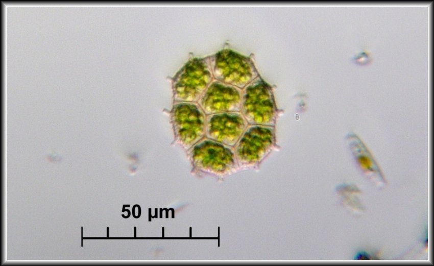 Nuovo Pediastrum per il forum